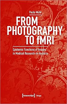 From Photography to fMRI: Epistemic Functions of Images in Medical Research on Hysteria
