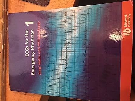 ECG's for the Emergency Physician 1