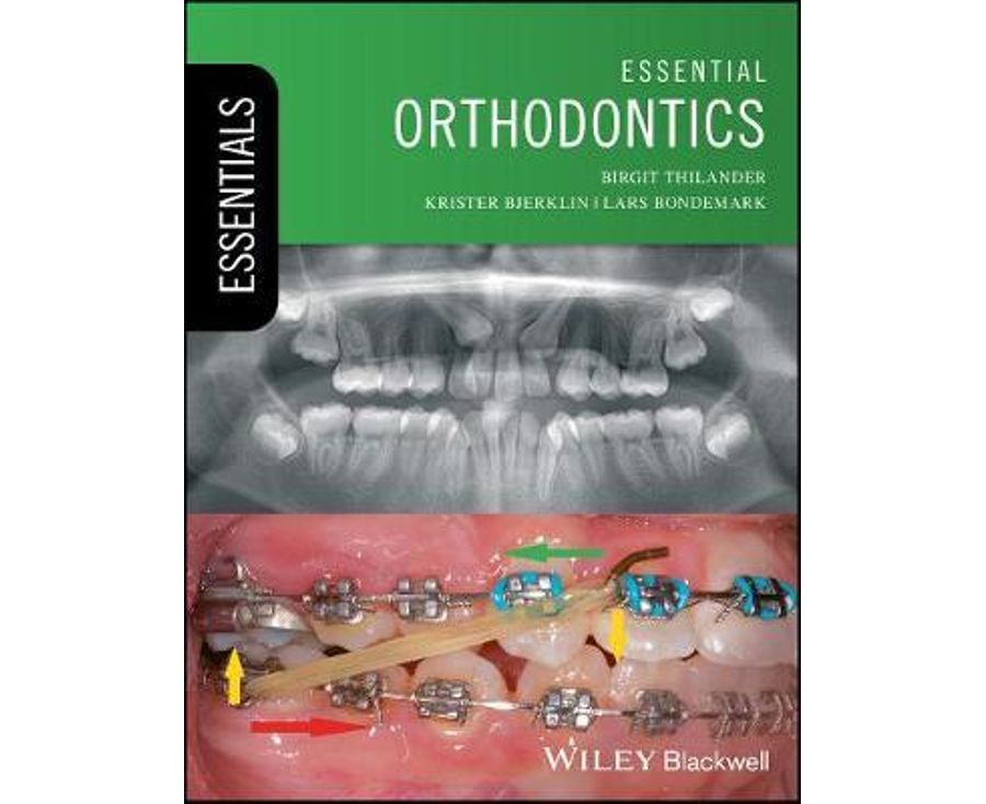 Essential Orthodontics